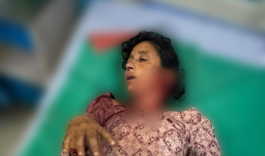 शुक्लाफाँटामा बाघको आक्रमणबाट महिला घाइते, माया मेट्रो अस्पतालमा उपचार हुँदै