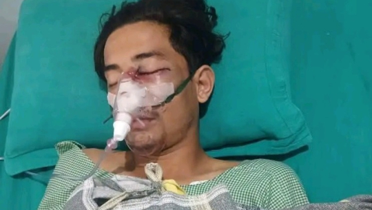 बेलौरीमा फुटबल खेलाडीमाथि कुटपिट गर्ने चार जनाविरुद्ध किटानी जाहेरी