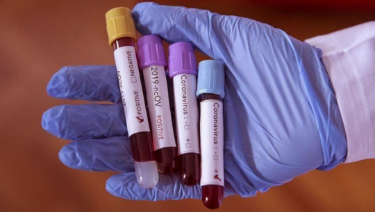 586 new cases of Coronavirus confirmed in one day in Nepal