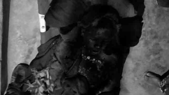 बाजुरामा डढेलो निभाउने क्रममा जलेर किशोरको मृत्यु