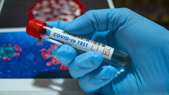 थप ५३ जनामा कोरोना संक्रमण पुष्टि