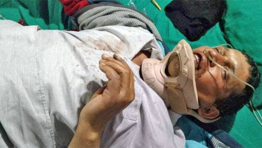 दार्चुलामा झडप हुँदा एमालेका अध्यक्ष उम्मेदवार घाइते