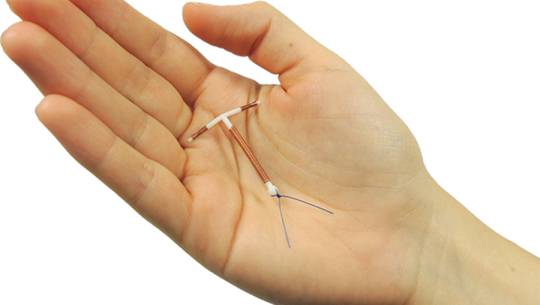 गर्भ निरोधक कपर–टीले ११ वर्षदेखि दिएको तनाव ४५ मिनेटमै समाधान