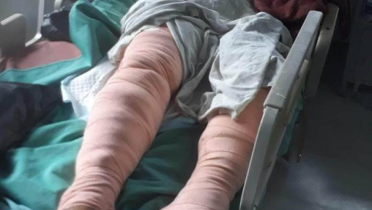 रहेनन् खड्का, डोटीमा करेन्ट लागेर घाईते भएको १८ दिनपछि मुत्यु