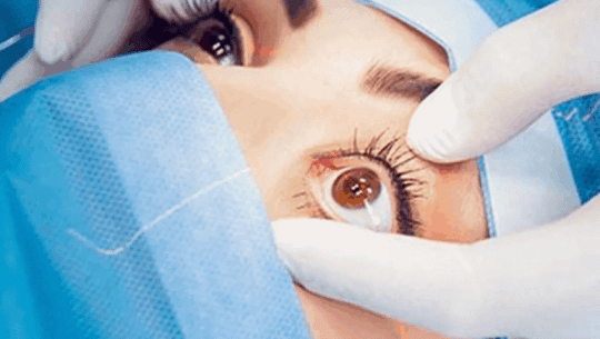 Over 7,000 people receive eye treatment services in Kanchanpur