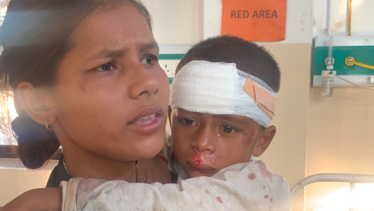 मोटरसाईकलको ठक्करबाट अछाममा बालक घाइते