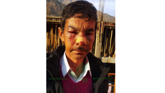 दार्चुलामा कांग्रेस सचिवद्वारा नेकपा सदस्यमाथि निर्घात कुटपीट