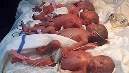 २५ वर्षीया महिलाले जन्माइन् एकैपटक ९ बच्चा