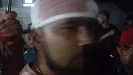 दार्चुलाको एक होटलमा युवाहरुबिच झडप, चार घाइते