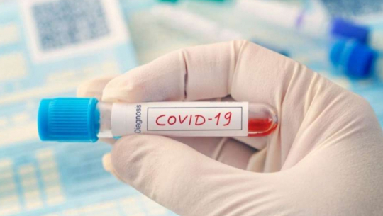 COVID-19 Cases Reported in Far West: 18 Individuals in Kailali Test Positive