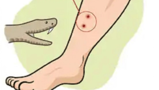 बैतडीमा सर्पले डसेर दुई जना घाइते