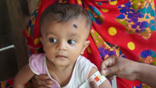 152 malnourished children identified in Baitadi in five days during nutrition screening campaign