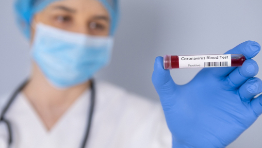 नुवाकोटमा कोरोना सक्रिय सङ्क्रमित सय नाघे