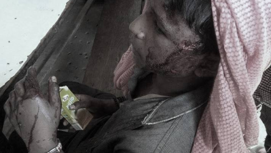 बाघको आक्रमणबाट अछाममा एक जना घाईते