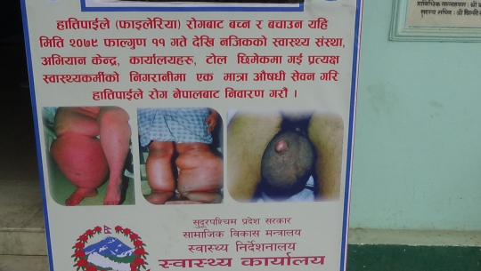 औषधि नखाइदिँदा कैलालीमा हात्तीपाइले रोगविरुद्धको अभियान निष्प्रभावी