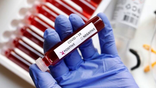 देशभर ६ सय ३८ जनामा कोरोना संक्रमण पुष्टि, २ जनाको मृत्यु  