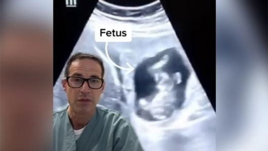 जब महिलाको कलेजोमा बच्चाको भ्रूण देखियो !