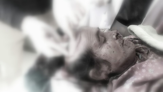 बझाङमा भालुको आक्रमणबाट ४० वर्षीय महिला गम्भीर घाइते