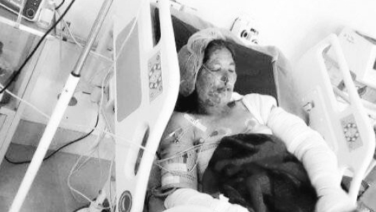 दार्चुलामा करेन्ट लागेर गम्भीर घाइते महिलाको मृत्यु