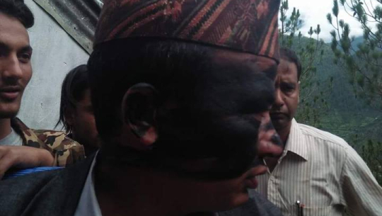 बझाङको मष्टा गाउँपालिकाका अध्यक्षलाई कालोमोसो