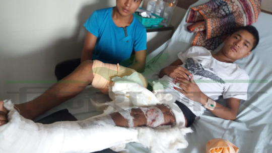फोटो क्यापसन : राष्ट्रिय ट्रमा सेन्टरमा उपचाररथ १७ बर्षिय शिब रोकाया 