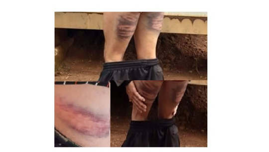 कंगोमा अधिकृतबाट नेपाली सैनिक कुटिए