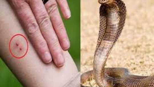 कैलालीमा सर्पले डसेर एक जना सिपाही घाइते