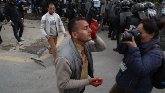 प्रहरी र एमालेका प्रदर्शनकारीबिच झडप, एक जनाको टाउको फुट्यो 