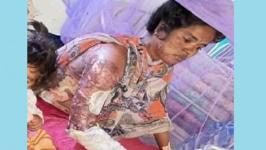 फाईल फोटो 