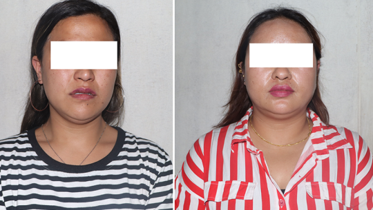 Two women arrested in Kathmandu for honey-trapping and extortion