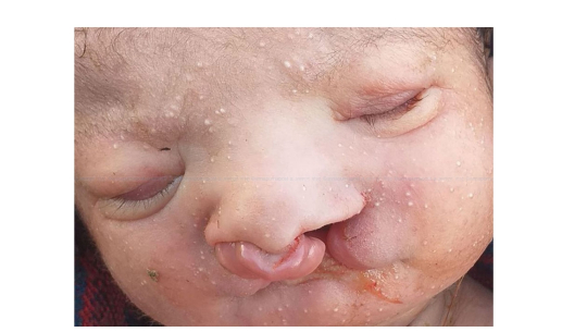 जन्मियो अनौठो बच्चा