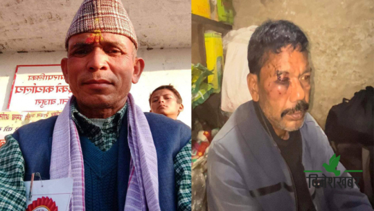 बाजुरामा दलितमाथि कुटपिट गर्ने वडाध्यक्षसहित ३ जना धरौटीमा छुटे