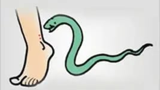 कञ्चनपुरमा सर्पको टोकाईबाट एक जना घाइते