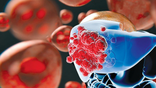 Cancer patient seeks financial assistance for treatment