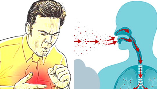 डडेल्धुरामा क्षयरोगका ७१ नयाँ बिरामी फेला परे