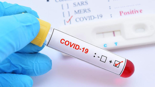 96 Nepalis dead, near 7000 infected by COVID-19 worldwide