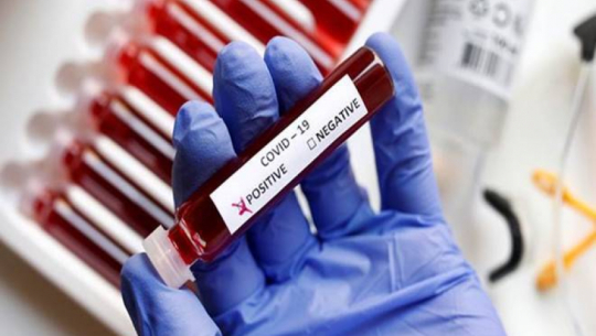 पछिल्लो २४ घण्टामा थप १५८ जनामा कोरोना सङ्क्रमण पुष्टि