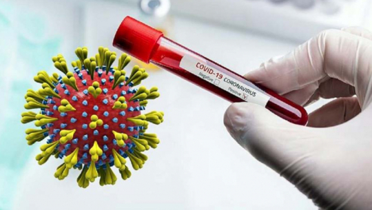 देशभर पछिल्लो २४ घण्टामा थप एक हजार २८२ जनामा कोभिड–१९ को सङ्क्रमण पुष्टि