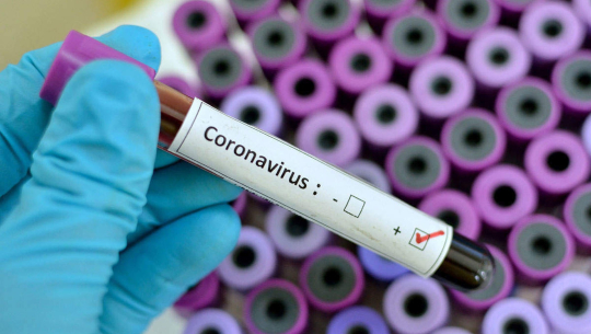 Coronavirus recoverd patients re-infected in Far-West