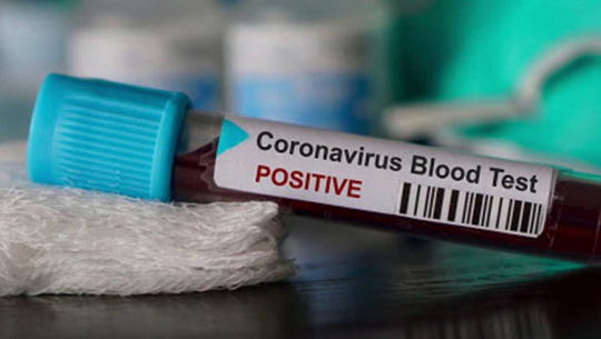 बाजुरामा आरडिटी पोजेटिभ देखाएको भन्दै स्वास्थ्यकर्मीमाथि ढुङ्गामुढा