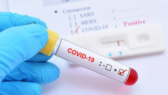 प्रदेश नं १ मा कोरोना सङ्क्रमण दर घट्दो