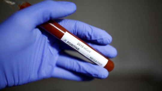 26 new cases of Coronavirus in Far-West