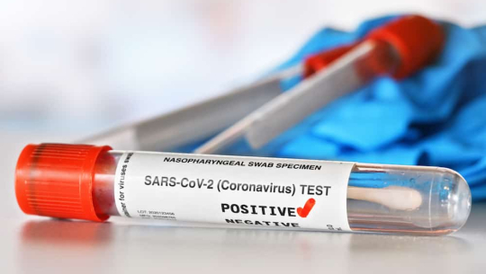 722 new cases of coronavirus recorded
