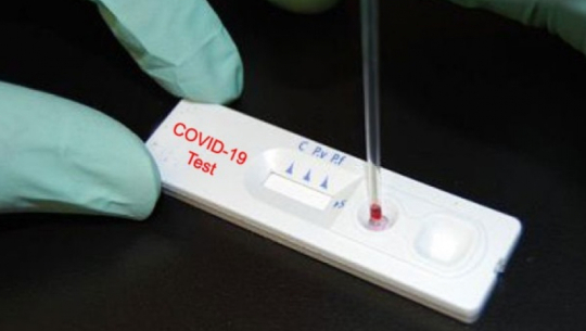 20 people rescued from Baitadi test positive for antibodies in Bajhang