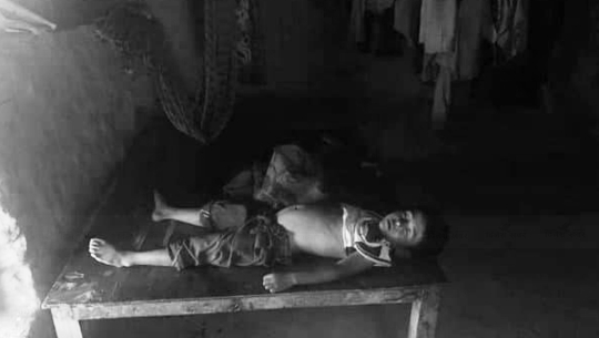 डडेल्धुरामा घरभित्रै पिङमा अल्झीएर ६ वर्षीय बालकको मृत्यु