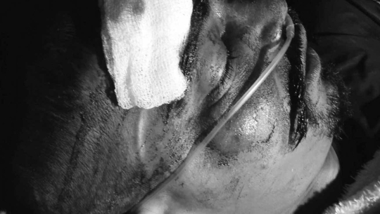 दार्चुलामा चोट लागेर बेहोस भेटिएका पुरुषको मृत्यु