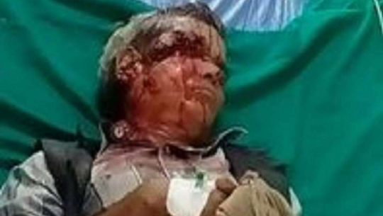 अछाममा भालुको आक्रमणबाट एकजना घाइते