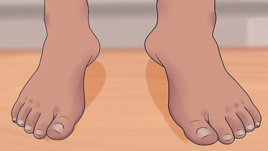 चैत २० गतेदेखि हात्तीपाइले रोग विरुद्धको औषधि खुवाइने