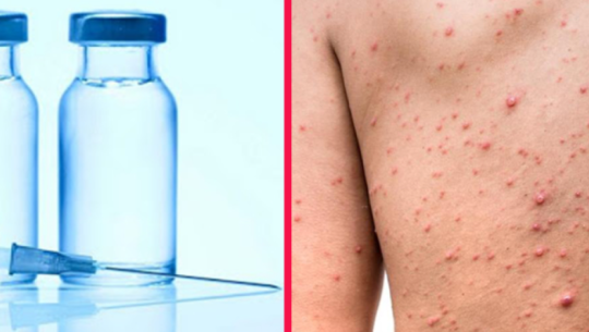 दादुराबाट एक हजारभन्दा बढी सङ्क्रमित