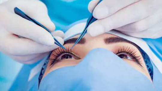 साठी जनाको आँखाको शल्यक्रिया